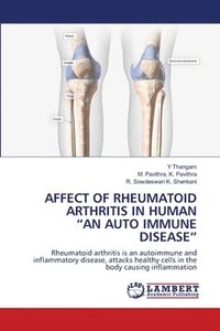 bokomslag Affect of Rheumatoid Arthritis in Human &quot;An Auto Immune Disease&quot;