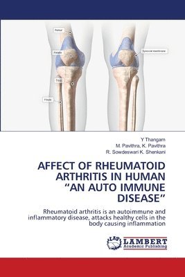 Affect of Rheumatoid Arthritis in Human &quot;An Auto Immune Disease&quot; 1