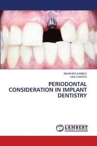bokomslag Periodontal Consideration in Implant Dentistry