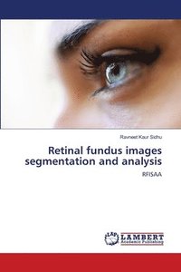 bokomslag Retinal fundus images segmentation and analysis