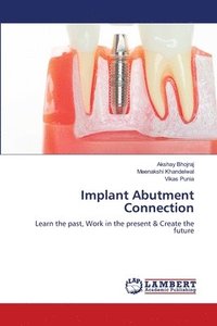 bokomslag Implant Abutment Connection