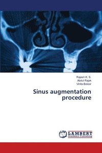 bokomslag Sinus augmentation procedure