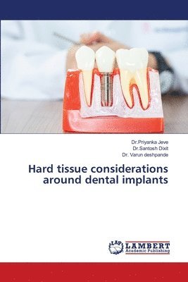 bokomslag Hard tissue considerations around dental implants