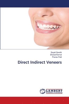 Direct Indirect Veneers 1
