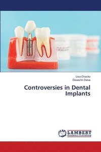 bokomslag Controversies in Dental Implants