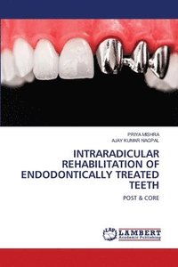 bokomslag Intraradicular Rehabilitation of Endodontically Treated Teeth