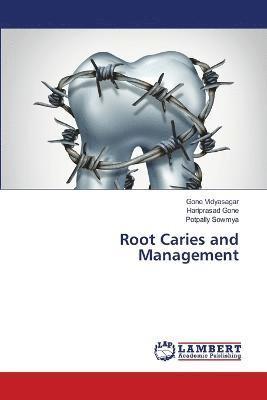 Root Caries and Management 1