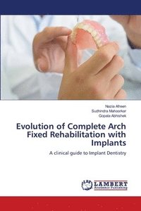bokomslag Evolution of Complete Arch Fixed Rehabilitation with Implants