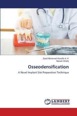 Osseodensification 1