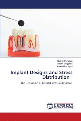 bokomslag Implant Designs and Stress Distribution