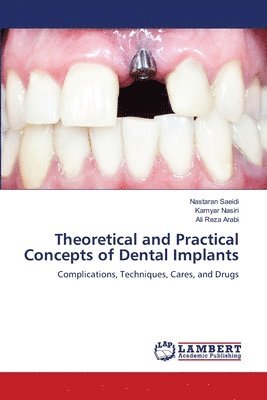 Theoretical and Practical Concepts of Dental Implants 1