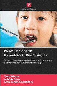 bokomslag Pnam: Moldagem Nasoalveolar Pré-Cirúrgica