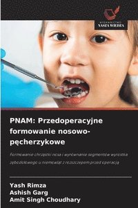 bokomslag Pnam: Przedoperacyjne formowanie nosowo-p?cherzykowe