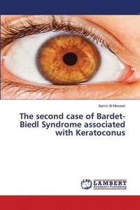bokomslag The second case of Bardet-Biedl Syndrome associated with Keratoconus