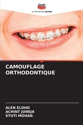 Camouflage Orthodontique 1