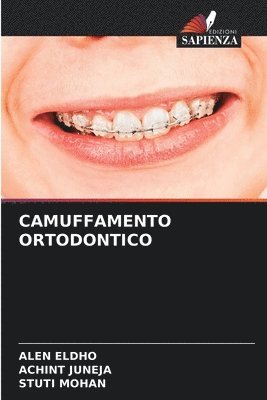 Camuffamento Ortodontico 1