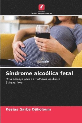 Sndrome alcolica fetal 1