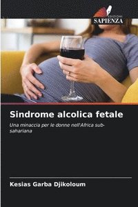 bokomslag Sindrome alcolica fetale