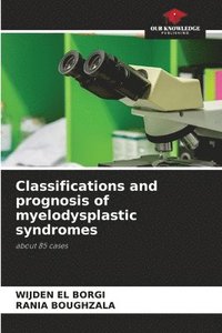 bokomslag Classifications and prognosis of myelodysplastic syndromes