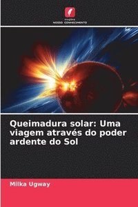 bokomslag Queimadura solar