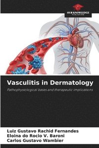 bokomslag Vasculitis in Dermatology