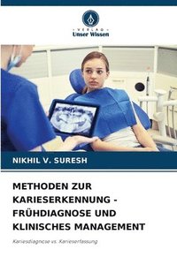 bokomslag Methoden Zur Karieserkennung - Frhdiagnose Und Klinisches Management