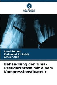 bokomslag Behandlung der Tibia-Pseudarthrose mit einem Kompressionsfixateur