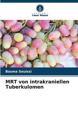 MRT von intrakraniellen Tuberkulomen 1