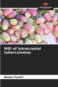 bokomslag MRI of intracranial tuberculomas