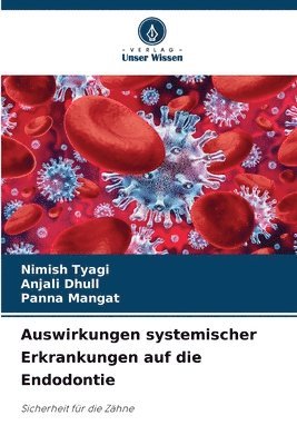 bokomslag Auswirkungen systemischer Erkrankungen auf die Endodontie