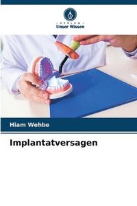 bokomslag Implantatversagen