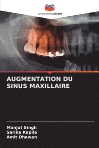 bokomslag Augmentation Du Sinus Maxillaire