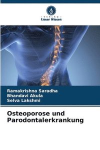 bokomslag Osteoporose und Parodontalerkrankung