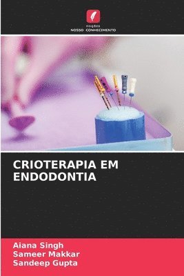 Crioterapia Em Endodontia 1