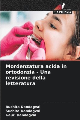 Mordenzatura acida in ortodonzia - Una revisione della letteratura 1