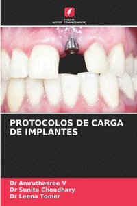 bokomslag Protocolos de Carga de Implantes