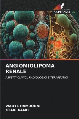 Angiomiolipoma Renale 1