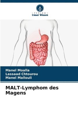 MALT-Lymphom des Magens 1
