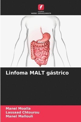 Linfoma MALT gstrico 1