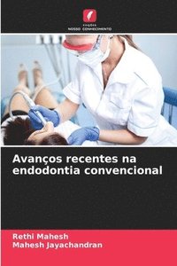 bokomslag Avanos recentes na endodontia convencional