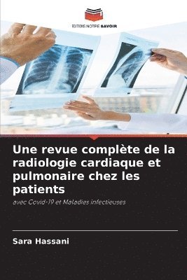 Une revue complte de la radiologie cardiaque et pulmonaire chez les patients 1