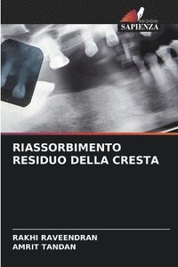 bokomslag Riassorbimento Residuo Della Cresta