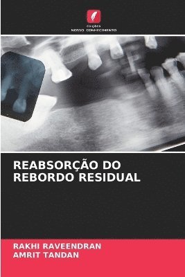 Reabsoro Do Rebordo Residual 1