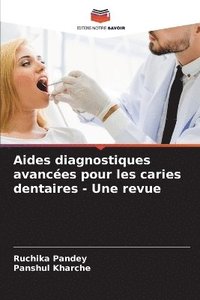 bokomslag Aides diagnostiques avances pour les caries dentaires - Une revue