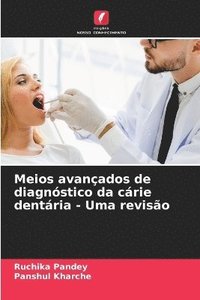 bokomslag Meios avanados de diagnstico da crie dentria - Uma reviso