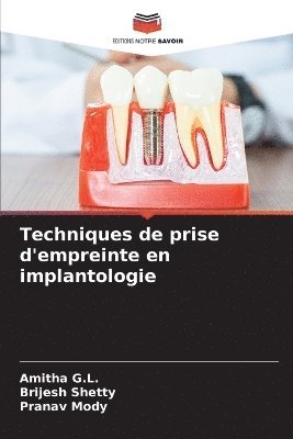 Techniques de prise d'empreinte en implantologie 1