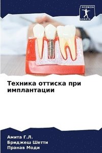 bokomslag &#1058;&#1077;&#1093;&#1085;&#1080;&#1082;&#1072; &#1086;&#1090;&#1090;&#1080;&#1089;&#1082;&#1072; &#1087;&#1088;&#1080; &#1080;&#1084;&#1087;&#1083;&#1072;&#1085;&#1090;&#1072;&#1094;&#1080;&#1080;