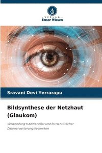 bokomslag Bildsynthese der Netzhaut (Glaukom)