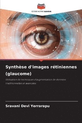 bokomslag Synthse d'images rtiniennes (glaucome)