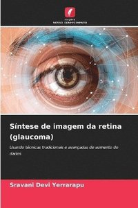 bokomslag Sntese de imagem da retina (glaucoma)